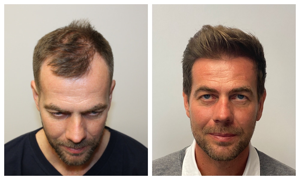 3183-hairs-Csaba.jpg