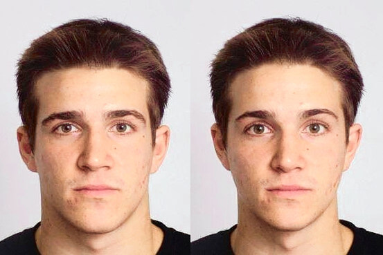 scientific-study-face-differences-social-experiment-control-photo-experimental-photo-jpg.125026
