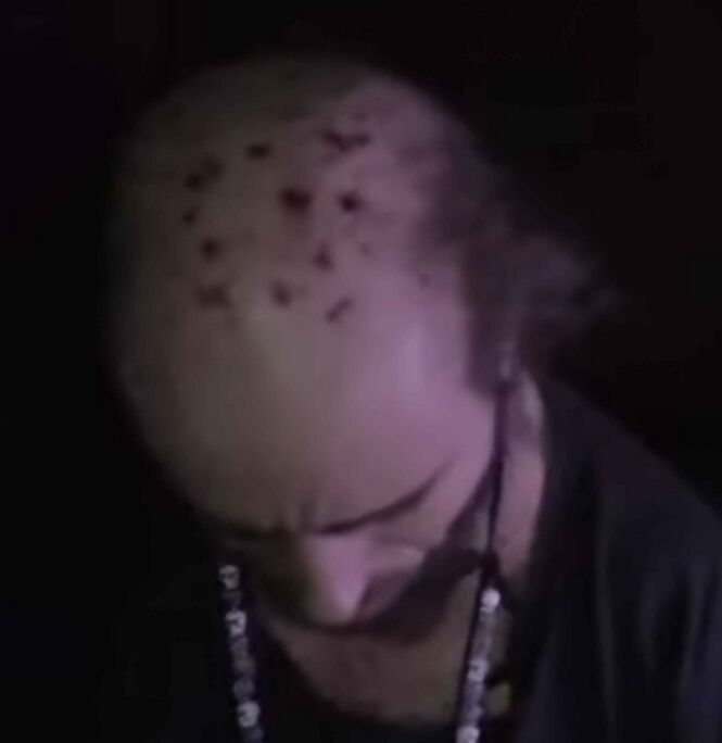 665px-Skull_scab.jpg