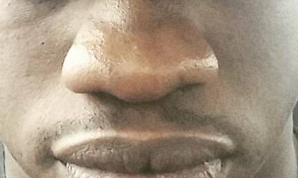 File:African black man nose.jpg - Wikimedia Commons