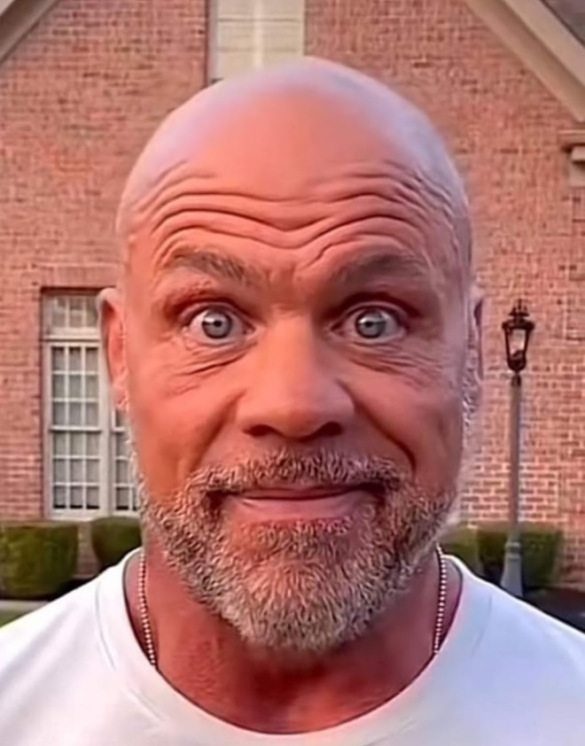 Bald_Guy_Staring.jpg