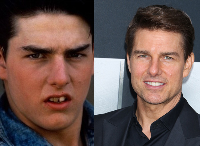 tom-cruise-teeth.jpg