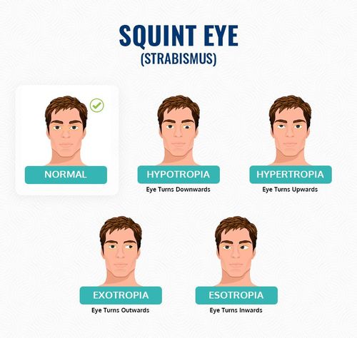 small_squint_eyes_2f8b61f542.jpg