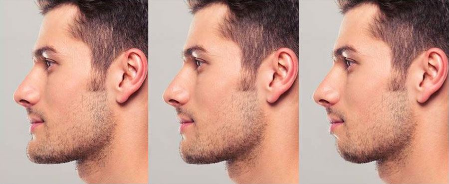 Chin-Position-Differences.jpg