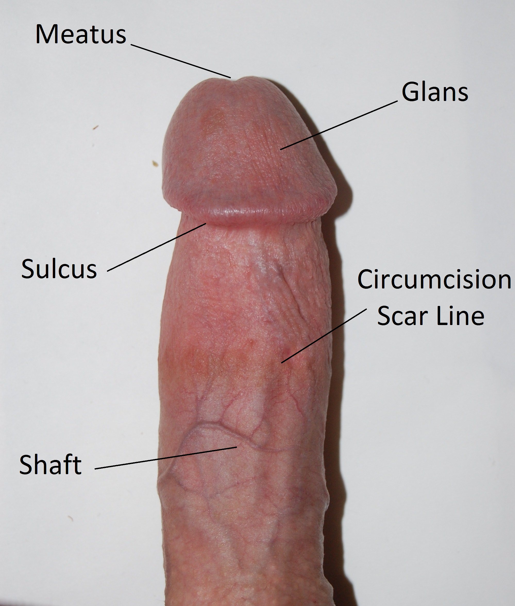 Circumcised_penis_edit.jpg