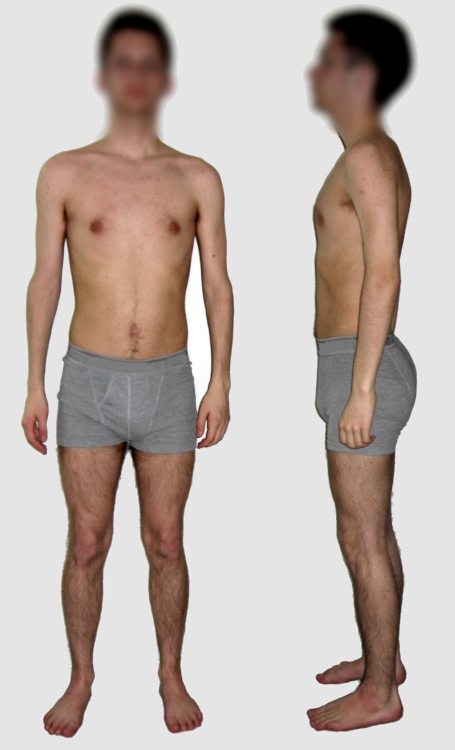 Male_borderline_underweight.jpg