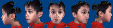 autismface34.png