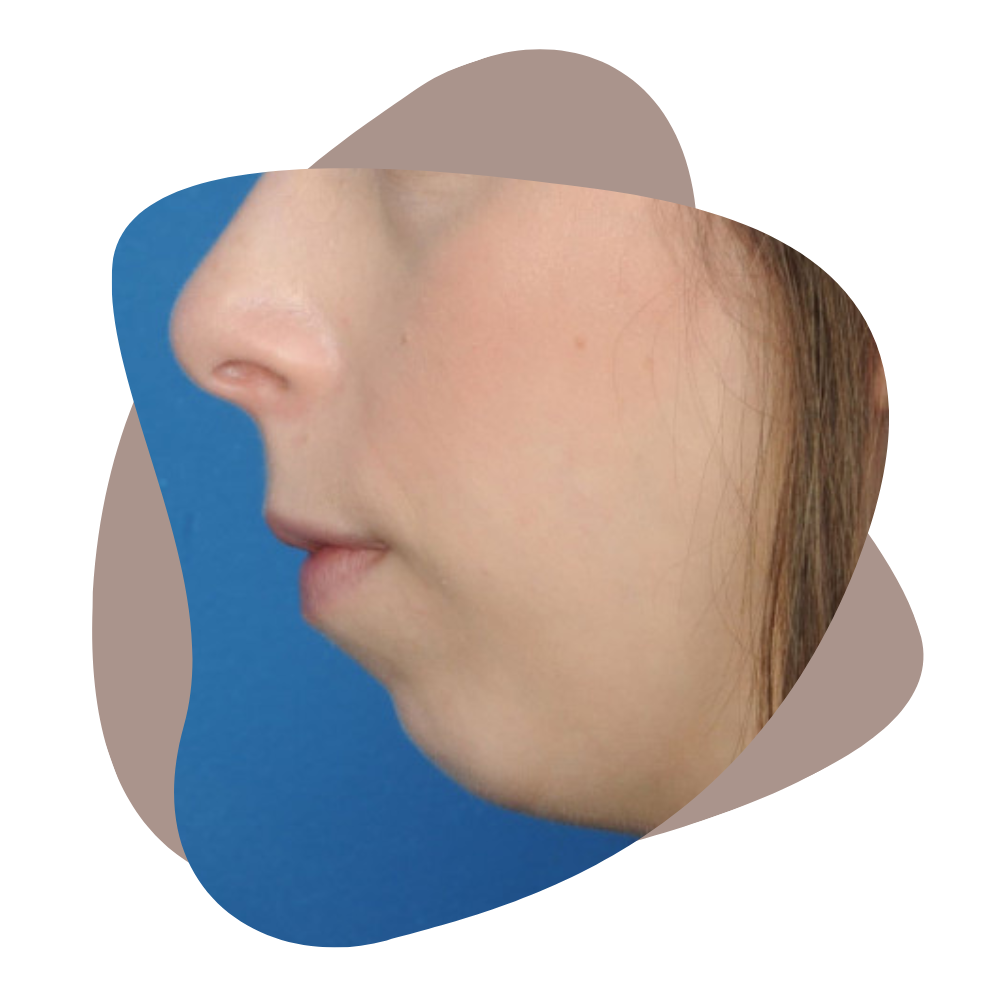1-13.png