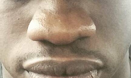 File:African black man nose.jpg - Wikimedia Commons
