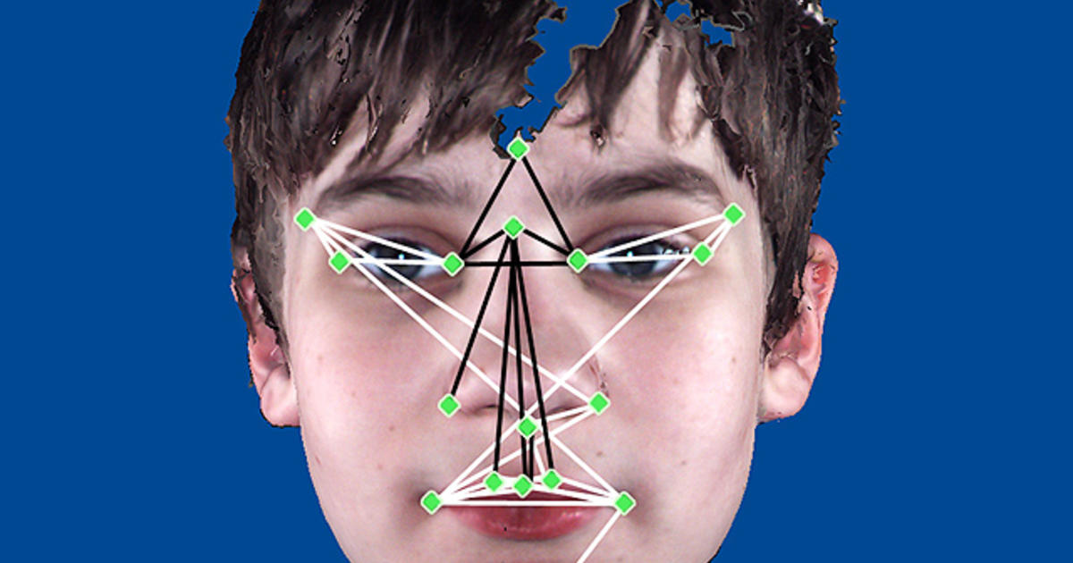 Is it autism? Facial features that show disorder