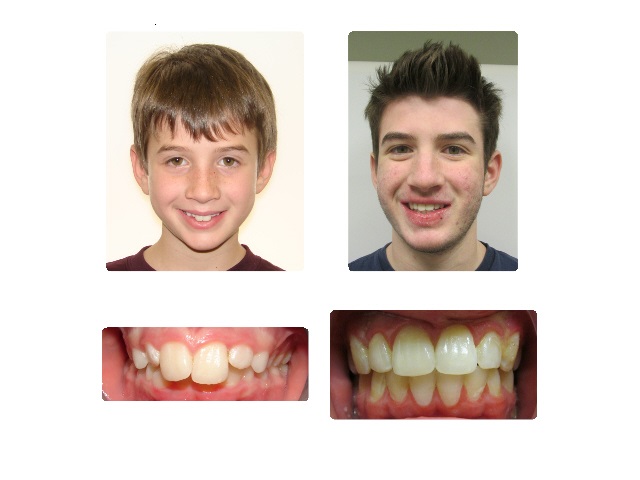 Before-after-41.jpg