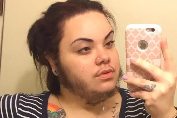 PAY-YOUNG-WOMAN-EMBRACES-HER-FULL-BEARD-IN-SPITE-OF-BULLIES-AND-HER-BOYFRIEND-SAYS-ITS-BEAUTIFUL.jpg