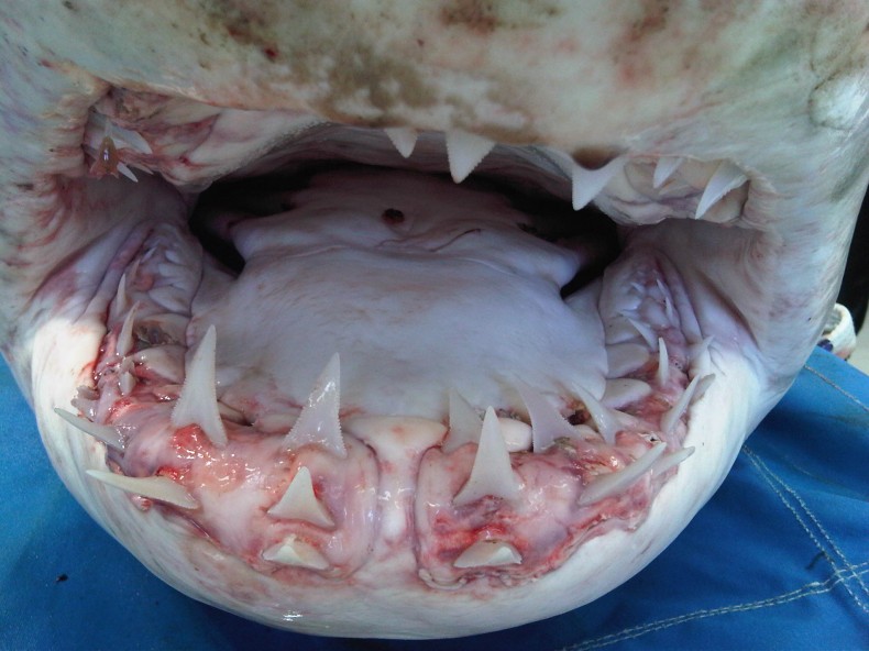 teeth-with-parasite-790x592.jpg