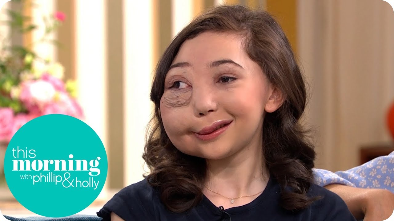 I Get Trolled for the Way I Look | This Morning - YouTube