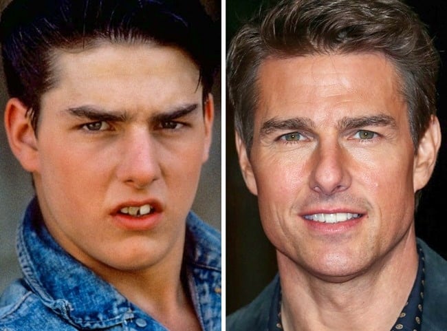 Tom-Cruise-Teeth.jpg