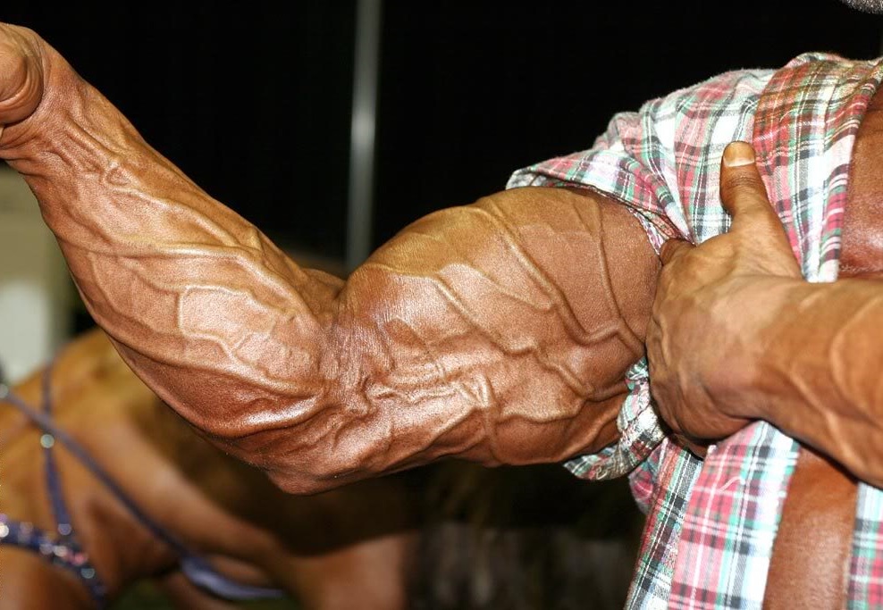 Man-With-Vascular-Arms.jpg