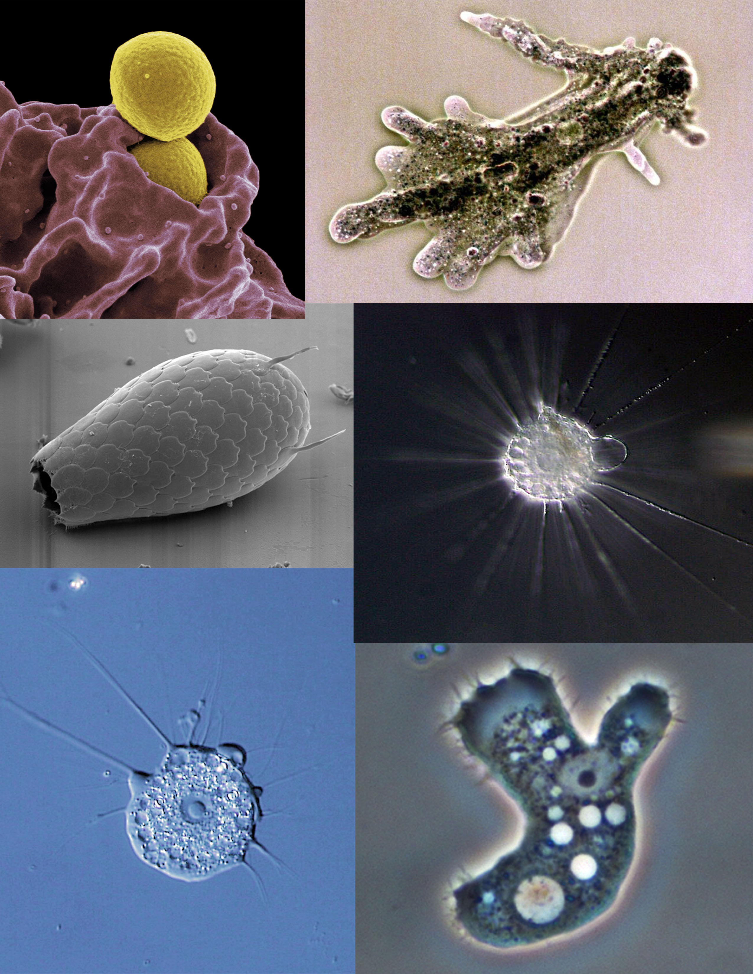 Amoeba_collage.jpg