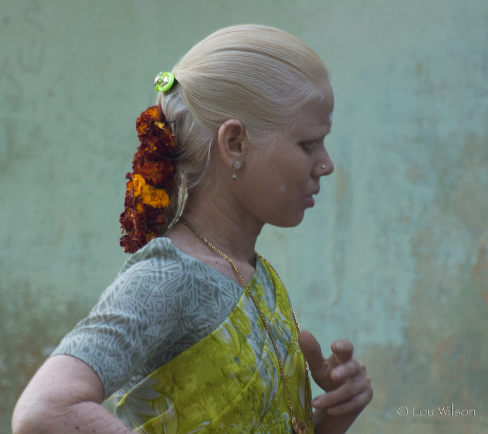 an-albino-indian-lady.jpg