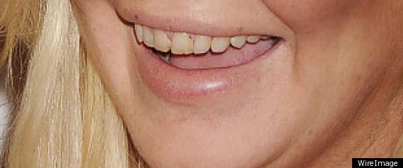 r-LINDSAY-LOHAN-TEETN-large570.jpg