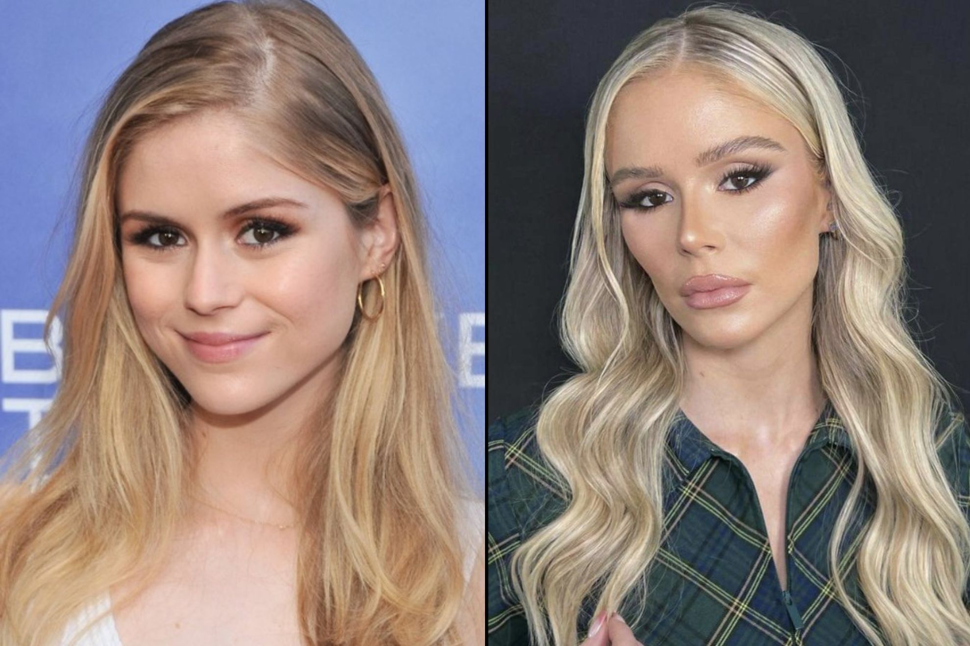 The Boys' actress Erin Moriarty's incredible before and after: Fans accuse  her of plastic surgery | Marca' actress Erin Moriarty's incredible before and after: Fans accuse  her of plastic surgery | Marca