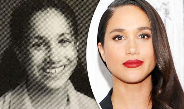 Meghan-Markle-plastic-surgery-832933.jpg