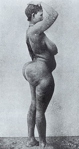 Woman_with_steatopygia.jpg