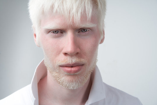 Albino Man Images – Browse 5,161 Stock Photos, Vectors, and ...