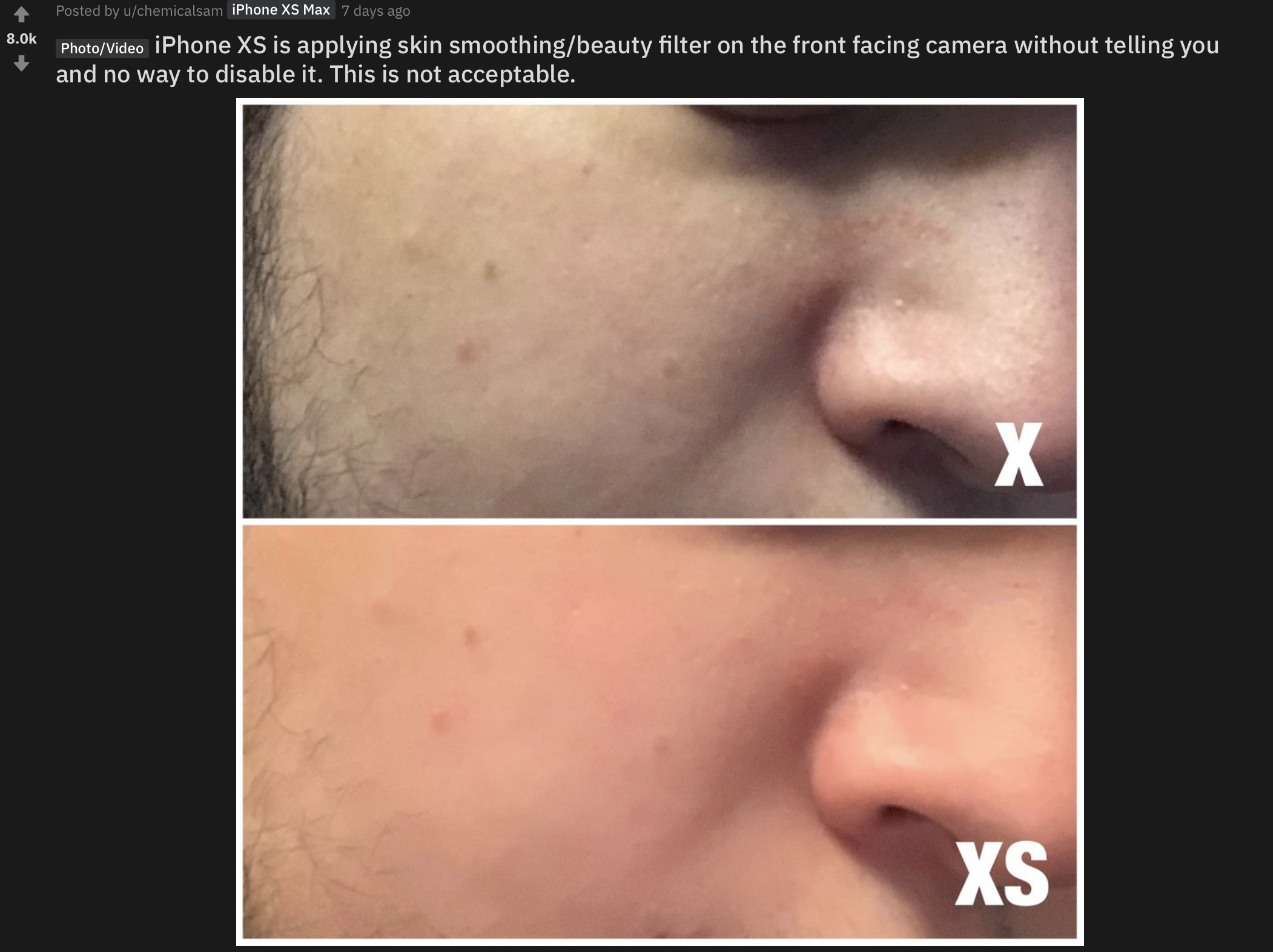  A Reddit thread claimed the iPhone XS smooths skin, removing detail