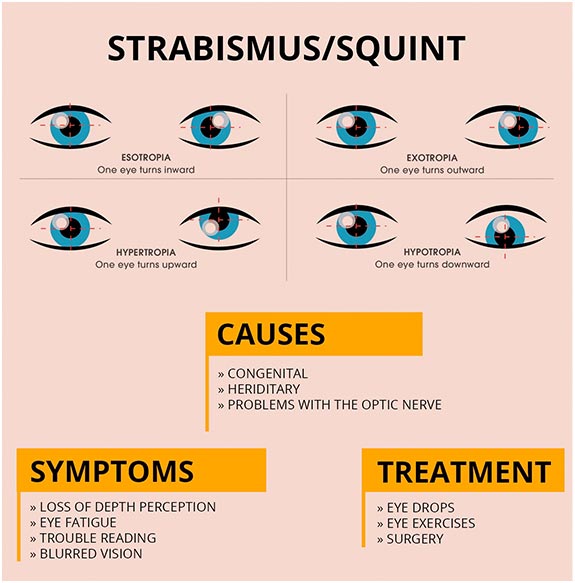 strabismus.jpg