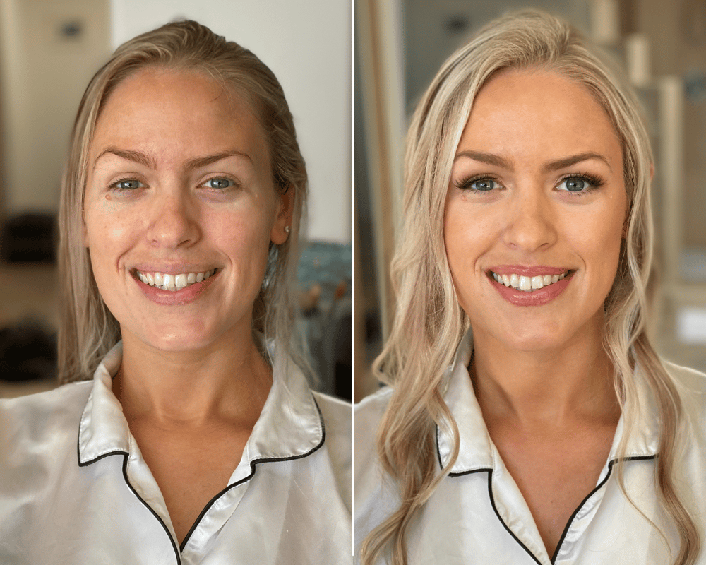 Before-After-Blog-3.png