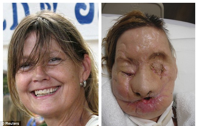 Woman jailed and cancer-therapy monkey confiscated after animal  accidentally scratches 10-year-old girl's face | Daily Mail Online