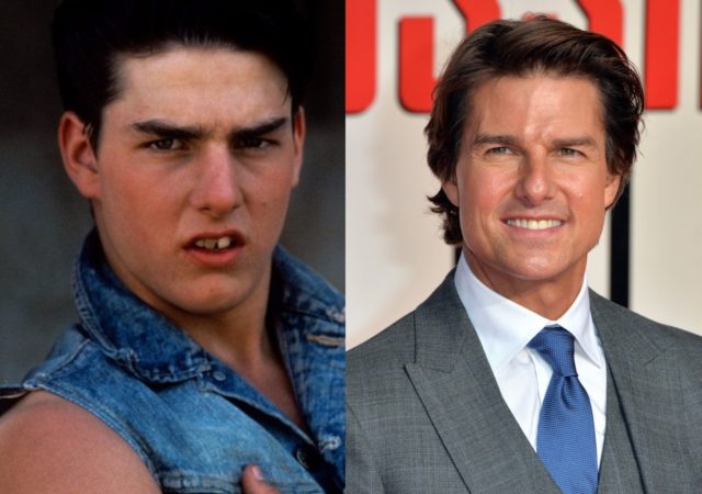 Tom-cruise-before-and-after-640x450.jpg