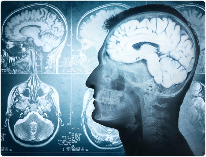 www.news-medical.net