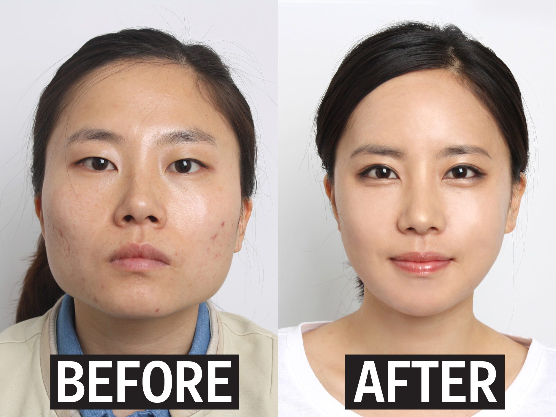 why-korean-parents-are-having-their-kids-get-plastic-surgery-before-college.jpg