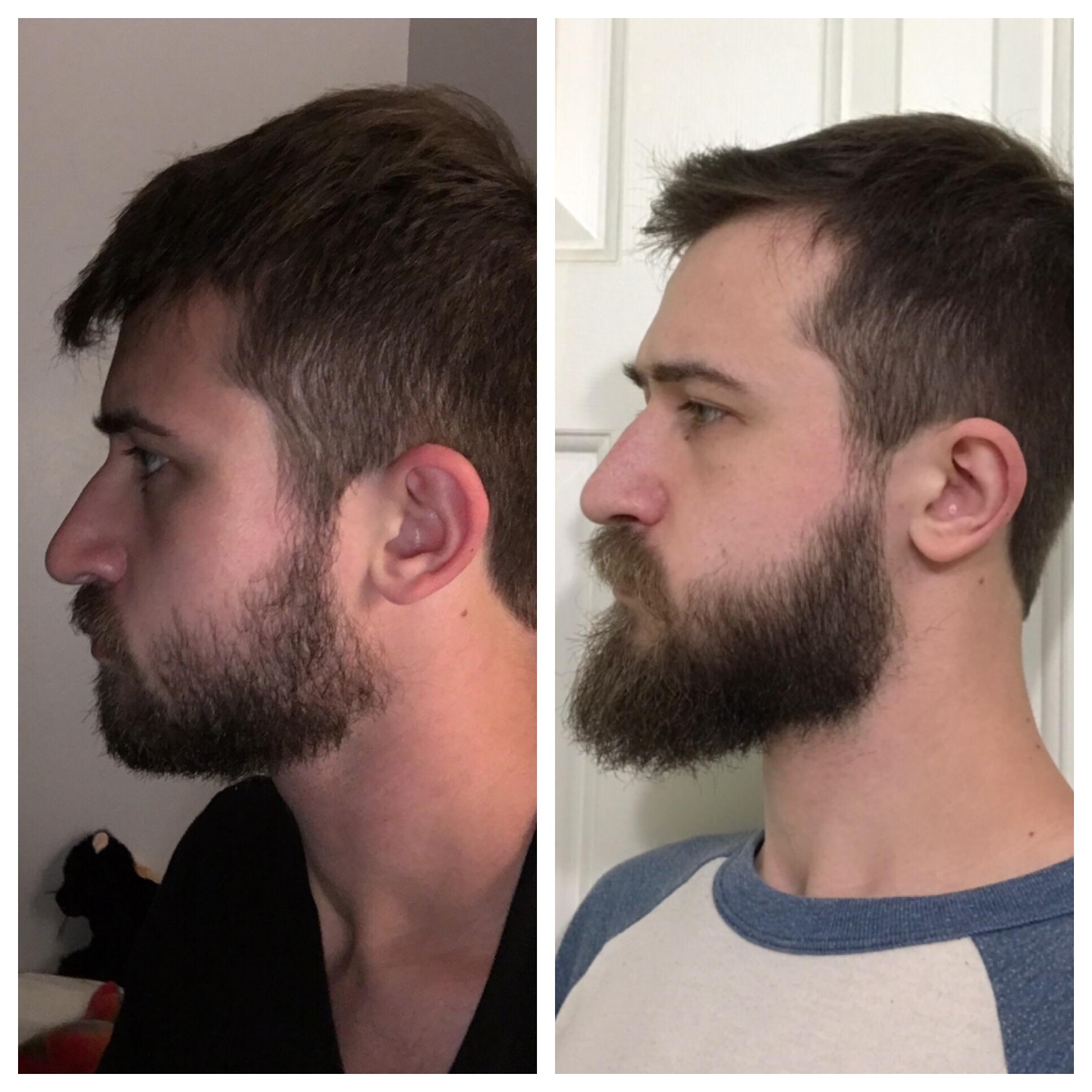 Beard For Weak Chin - Wavy Haircut
