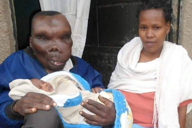 Baguma Godfrey,Uganda's Ugliest Man gets his 8th child!
