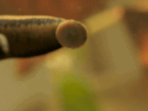 Watch: See how leeches can be a surgeon's sidekick | MPR News