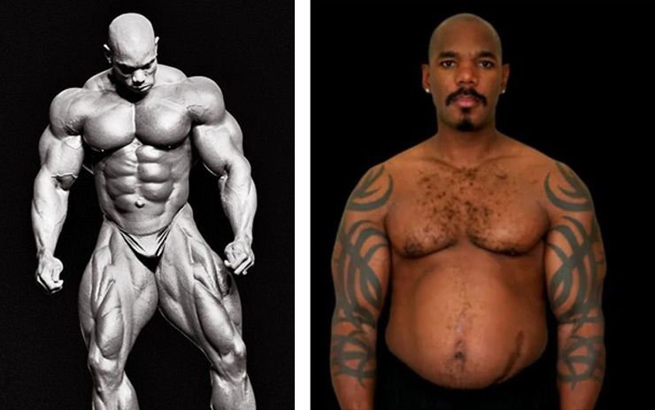 Before After Pictures Of Bodybuilders Showing What Happens When They Stop  Taking Steroids