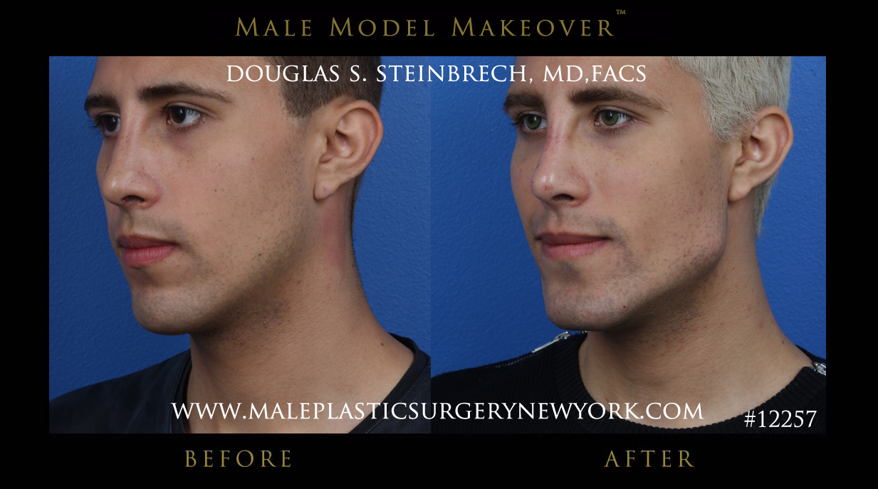male-model-makeover-mps-ny-1-1.jpg