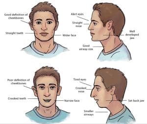 mouth-breathing-face-vs-nose-breather-300x252.jpg