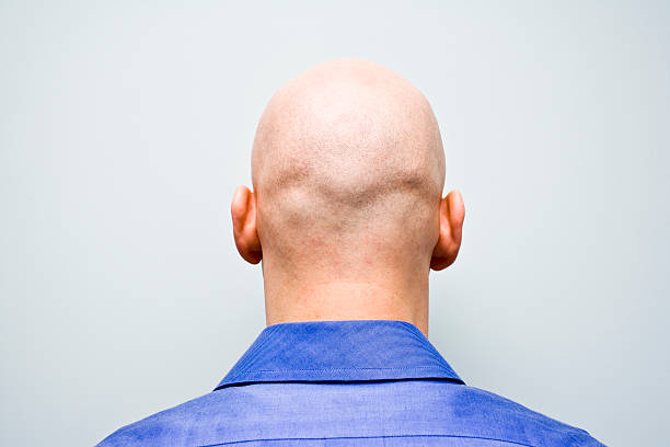 back-of-man-ist-bald-head.jpg