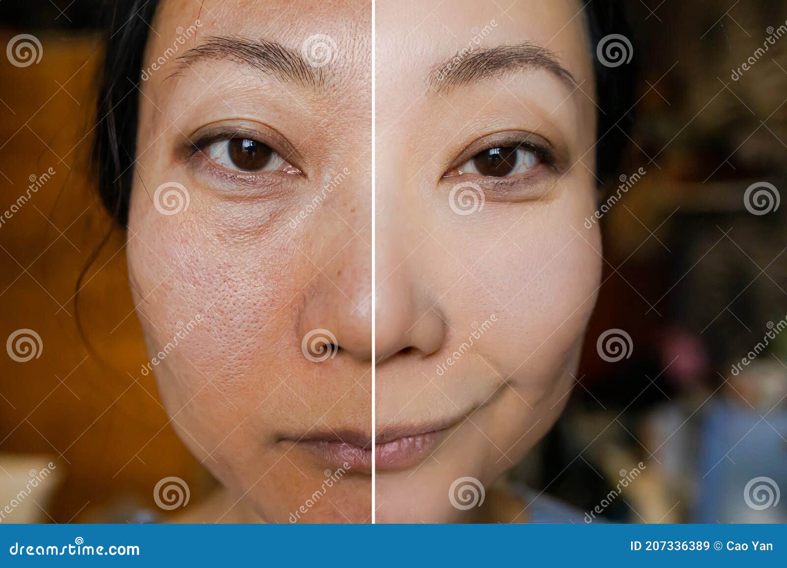 concept-skin-rejuvenation-cosmetic-operation-whitening-cream-asian-women-concept-good-skin-rejuvenation-207336389.jpg