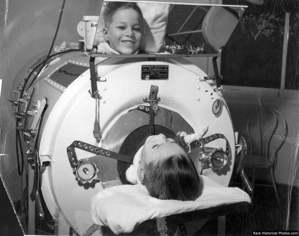 The Iron Lung | Science Museum